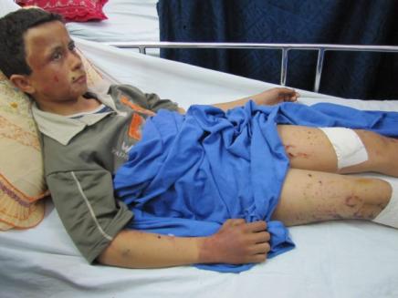 Hani Al-Qanoo: 15 years old